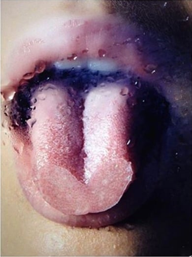 Cryo Feature Image - Image Credit - Camilla Akrans Eat Beautiful